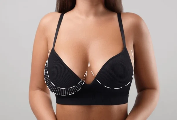 Breast Reduction Surgery